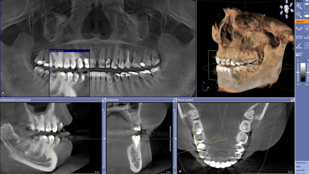 рентген снимок зубов