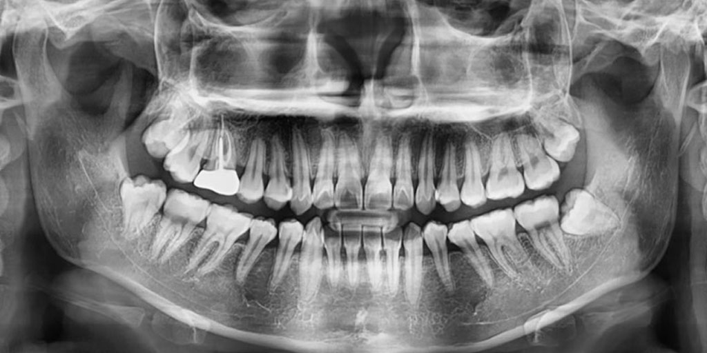 рентген челюсти