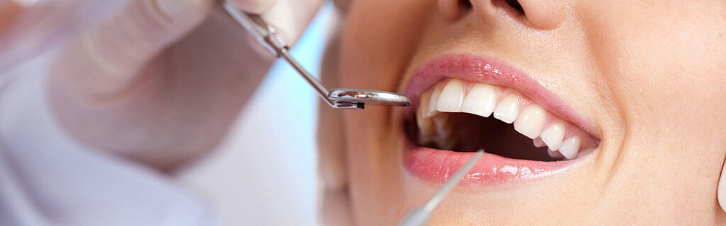 обследование зубов