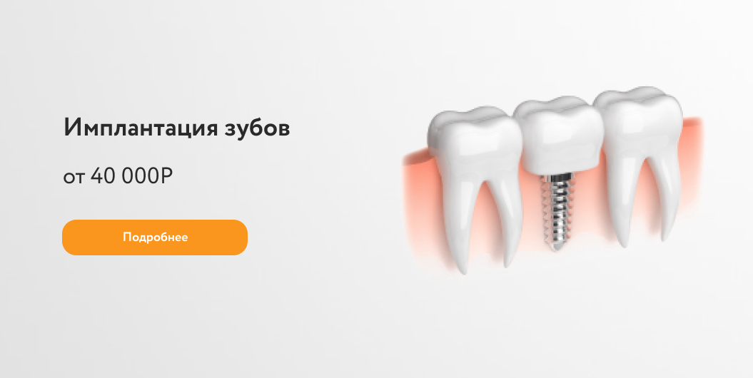 https://doctorlemberg.ru/services/implantologiya/implantaciya-zubov-pod-kljuch